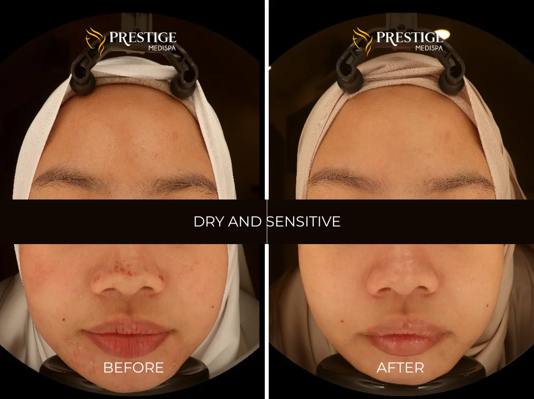 Add a little bit of body text - 1