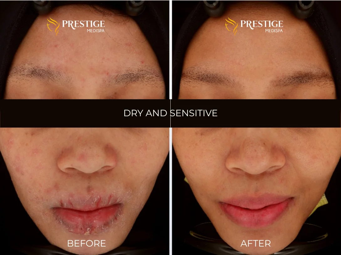 Add a little bit of body text - 2