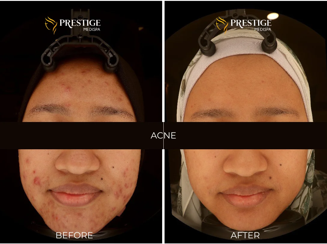 Add a little bit of body text - 3