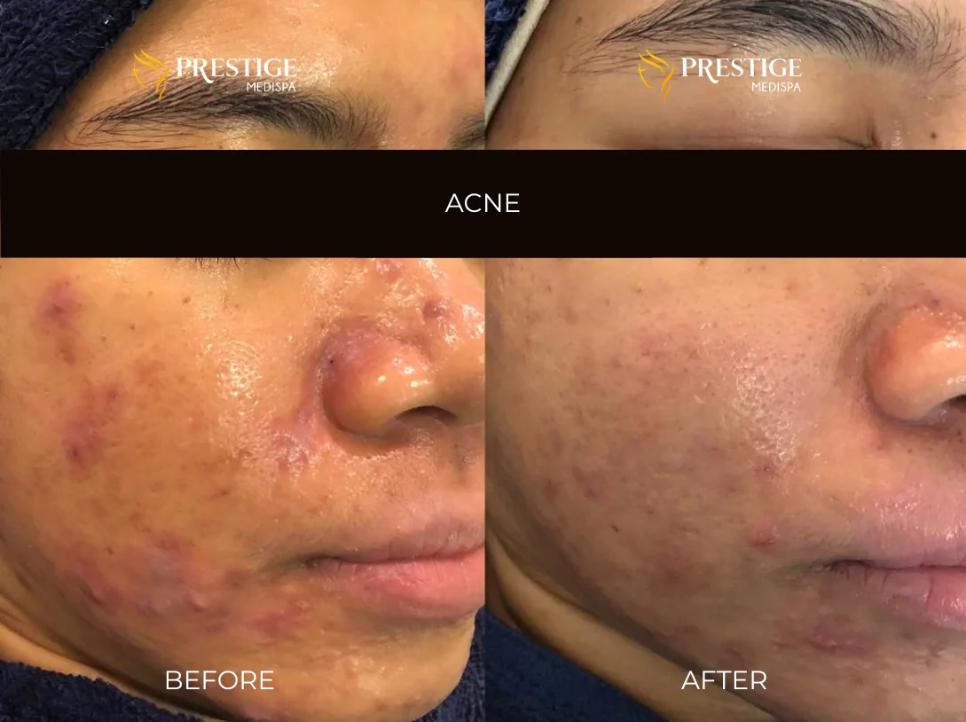 Add a little bit of body text - 4