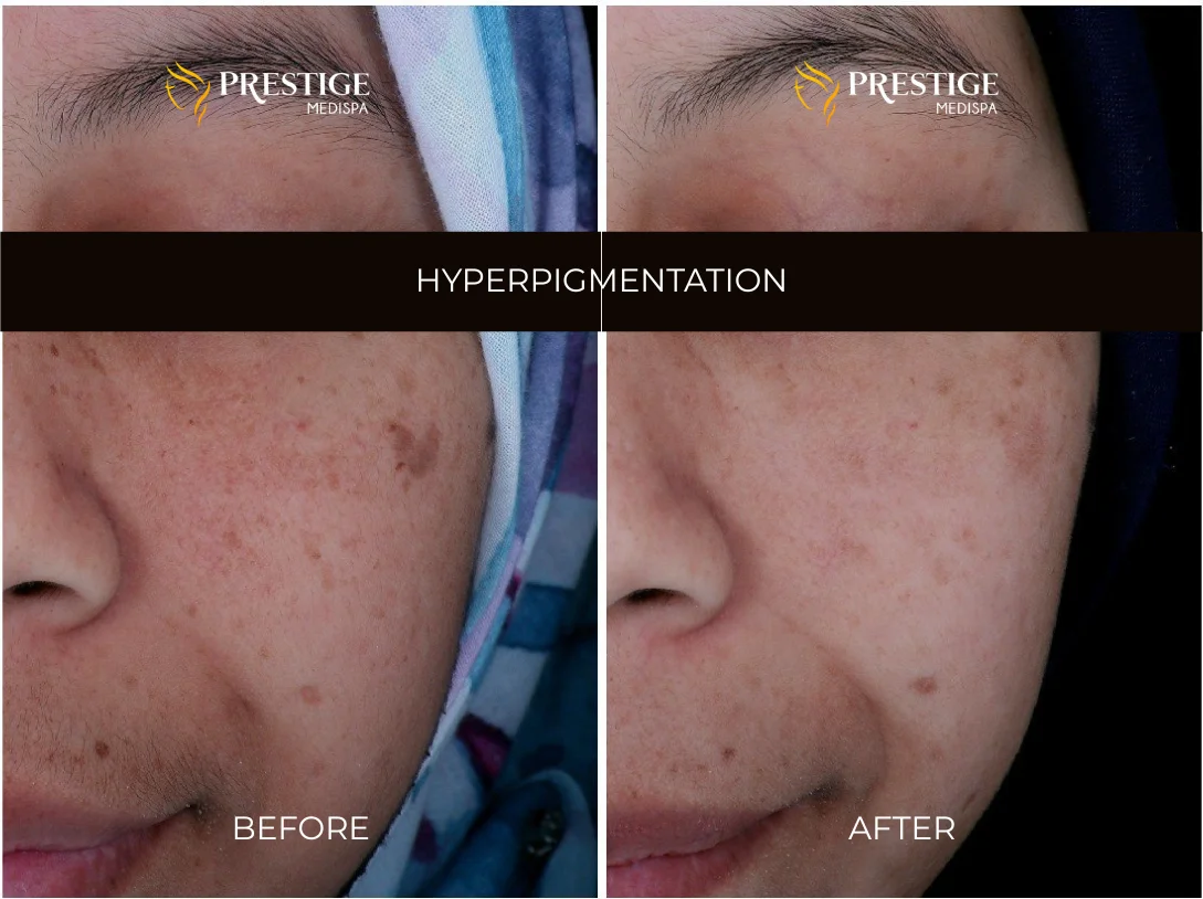 Add a little bit of body text - 5