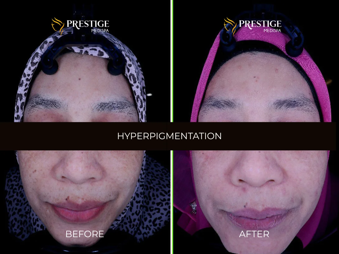 Add a little bit of body text - 6