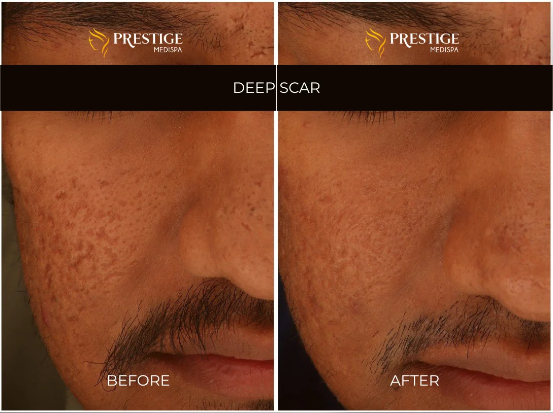 Add a little bit of body text - 7