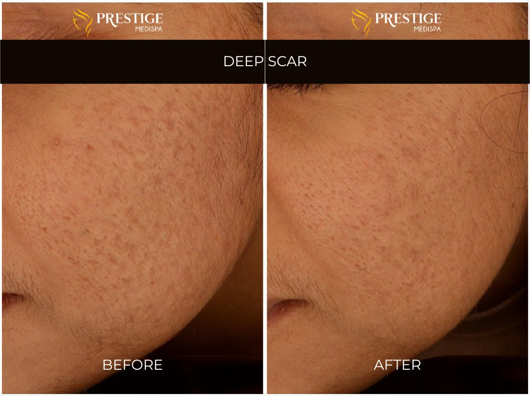 Add a little bit of body text - 8